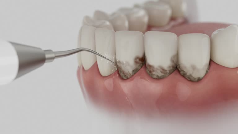 Trusted Teeth Cleaning And Checkup service in Cass City, MI - Dentist Open Now
